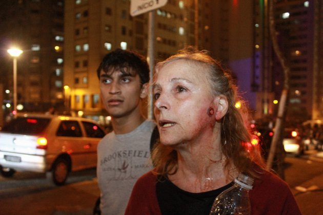 Maria Bernardete de Carvalho, pedestre que não participava da manifestação contra o aumento da terifa do transporte público e acabou atingida por projétil de borracha, durante o confronto entre manifestantes e policiais militares, nesta quinta-feira (13), no centro de São Paulo.