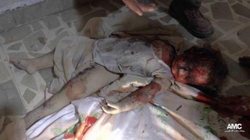 A toddler killed by an Assad tank shell in Aleppo, Syria on July 24, 2013. 