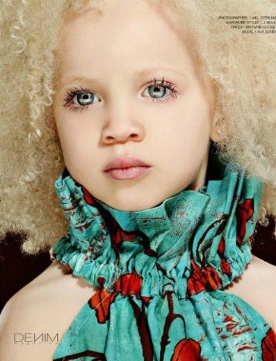 blackbeautyoftheday:

Ava Edney (Albino Baby Fashion Model)
