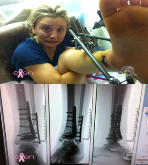 Kaley Cuoco's accident aftermath S