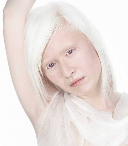 Albino Chinese