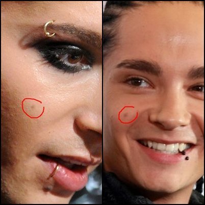 I thought that only Tom had that mole.
