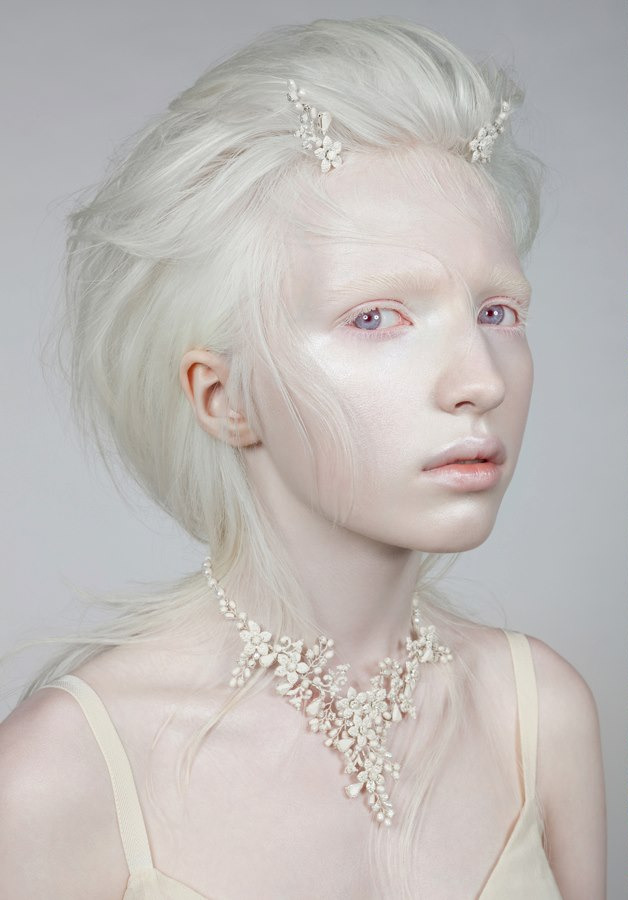 Albino White Teen 79
