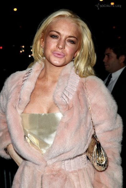 a classic lindsay lohan duckface pic. is this chick even still alive? if we had to take a wild guess based on how bad she looks in this pic, we&#8217;d say &#8220;uh, no.&#8221;