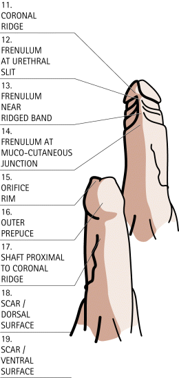 Sensitive Areas Of The Penis 118