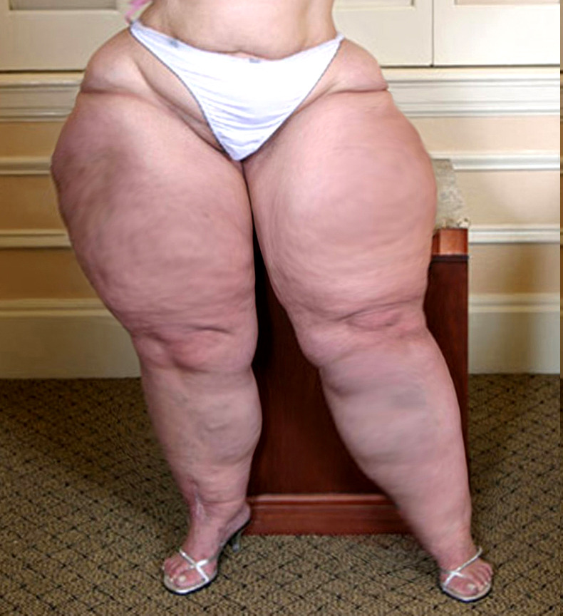 Women With Fat Thighs 17