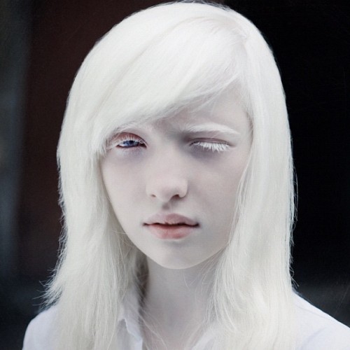 Albino White Teen 79